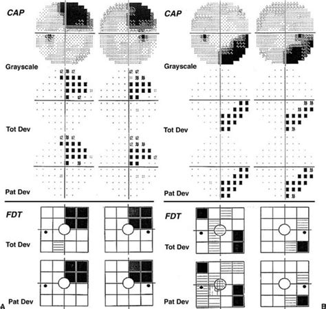 fdt test|perception quiz.